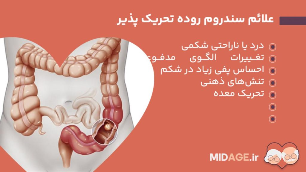 سندروم روده تحریک پذیر