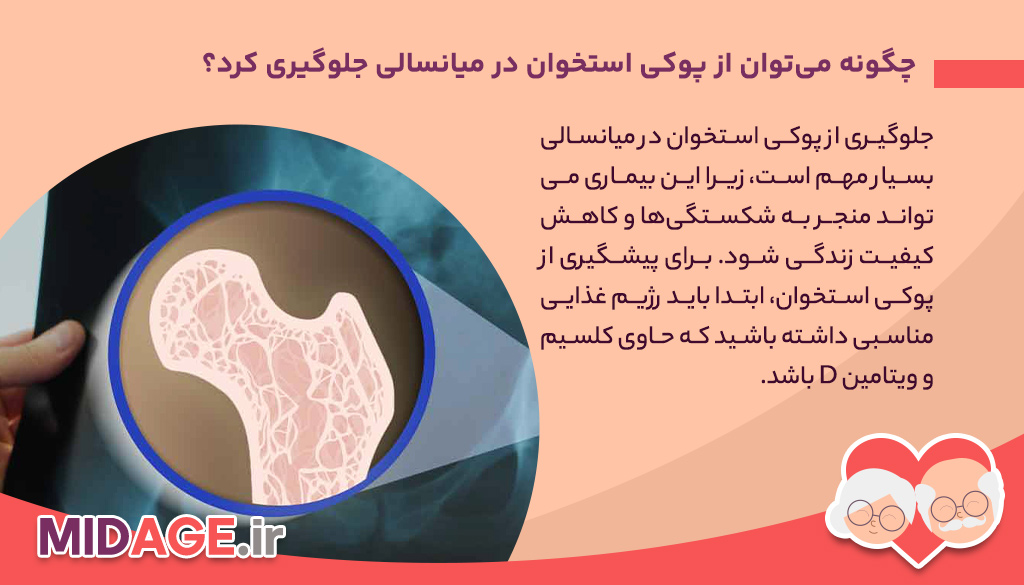 بیماری های میانسالی را بشناسید!