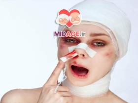 آیا عمل زیبایی در میانسالی کار درستی است؟