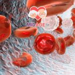 دلایل ابتلا به کم ‌خونی در میانسالی چیست؟