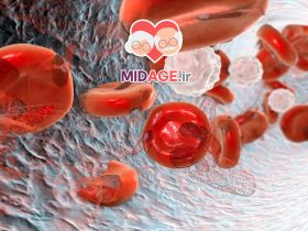 دلایل ابتلا به کم خونی در میانسالی چیست؟ دلایل ابتلا به کم خونی در میانسالی چیست؟