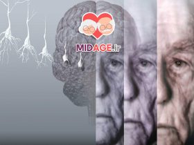 آیا آلزایمر در سالمندی به سراغ مان می آید؟ آیا آلزایمر در سالمندی به سراغ مان می آید؟