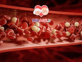 روش های موثر برای جلوگیری از افزایش کلسترول خون در میانسالی