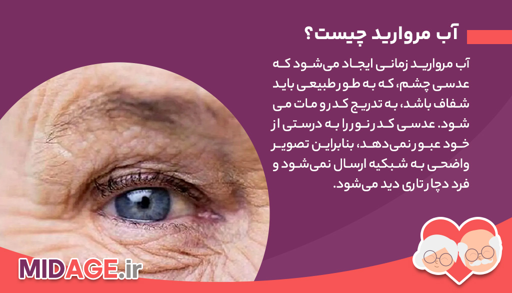 آب مروارید در سالمندی چیست و چه علائمی دارد؟