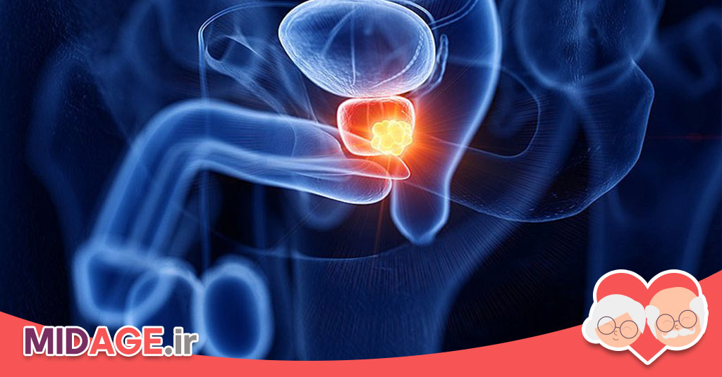 بیماری پروستات چیست و چرا به آن مبتلا می شویم؟