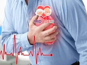 سفتی عروق در سالمندی سفتی عروق در سالمندی