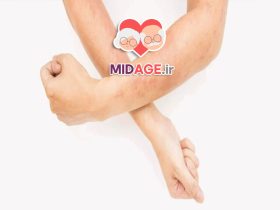 درماتیت عصبی در میانسالی+ هنوز دیر نیست! درماتیت عصبی در میانسالی+ هنوز دیر نیست!