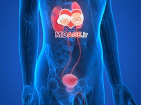 فتق بیضه در میانسالی چیست؟