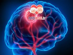  تومور مغزی: شناخت، علائم، تشخیص و درمان