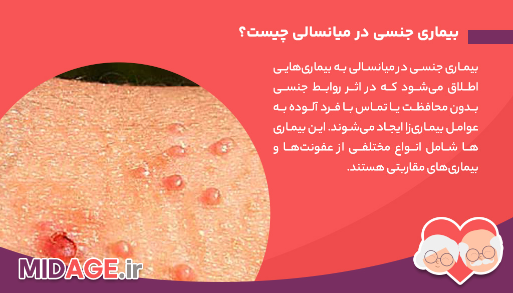 بیماری جنسی در میانسالی: چالش‌ها، علائم و پیشگیری