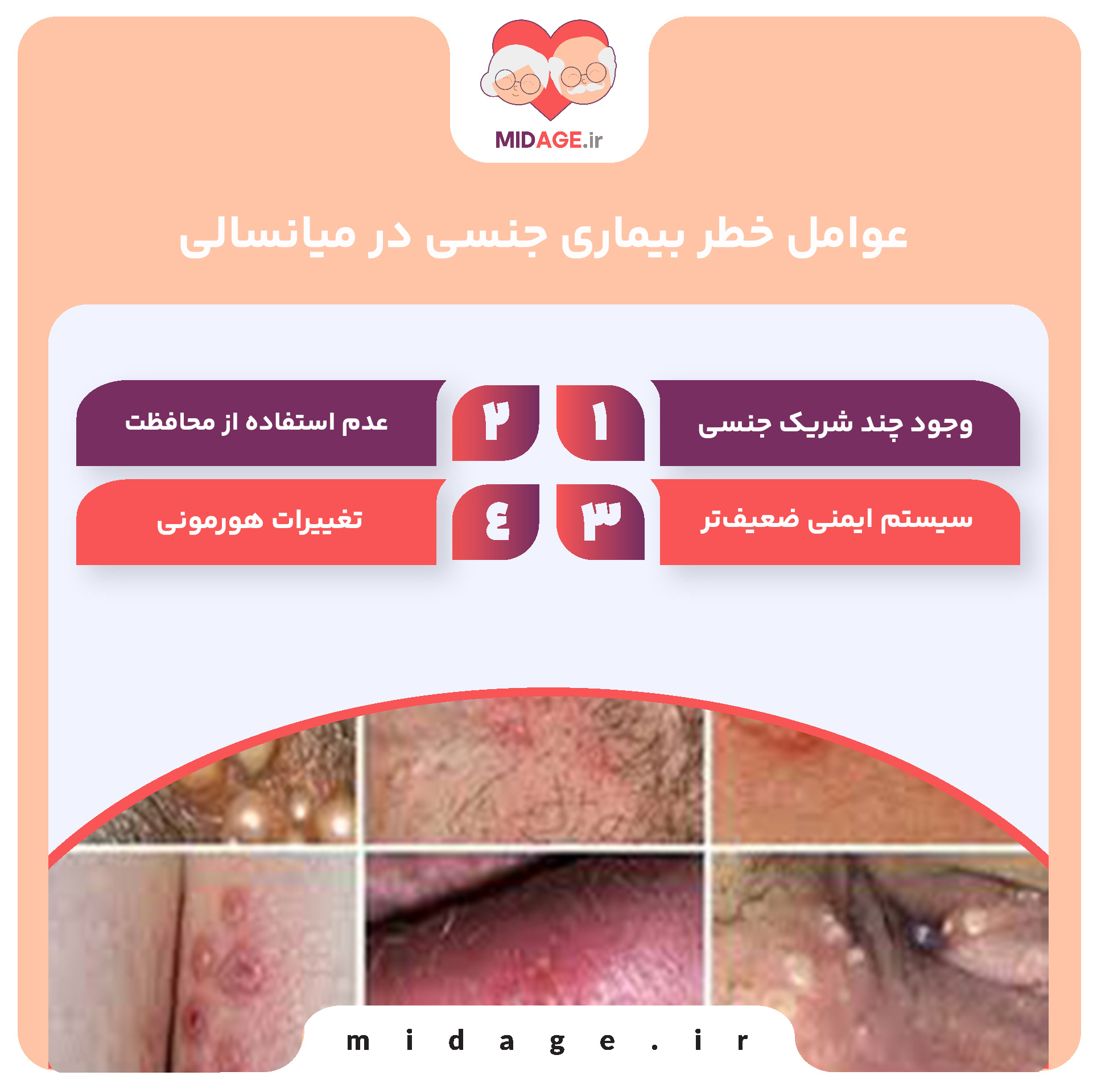 بیماری جنسی در میانسالی: چالش‌ها، علائم و پیشگیری
