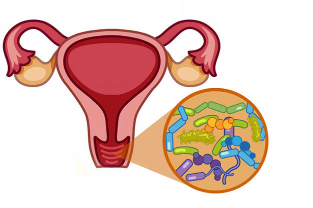 عفونت واژن داری؟ با این روشها در خانه درمانش کن قبل از اینکه شدید بشه! عفونت واژن داری؟ با این روشها در خانه درمانش کن قبل از اینکه شدید بشه!