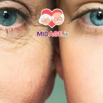 تئوری های پیری؛ راز دیرینه‌ی فرسودگی بدن انسان