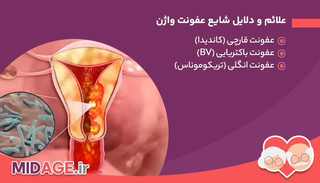 علائم و دلایل شایع عفونت واژن