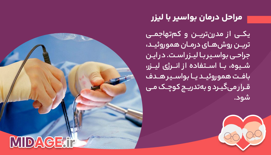 مراحل درمان بواسیر با لیزر