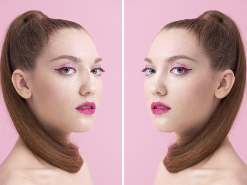 8 ویژگی کلیدی مهم در انتخاب جراح ترمیم بینی 8 ویژگی کلیدی مهم در انتخاب جراح ترمیم بینی