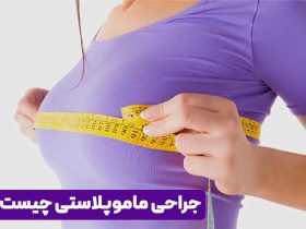 جراحی ماموپلاستی چیست و چقدر هزینه دارد ؟