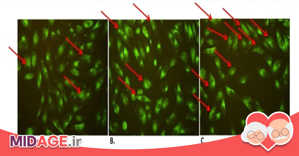 القای اتوفاژی توسط ترکیبات طبیعی: مکانیسمها، کاربردها و مزایا القای اتوفاژی توسط ترکیبات طبیعی: مکانیسمها، کاربردها و مزایا