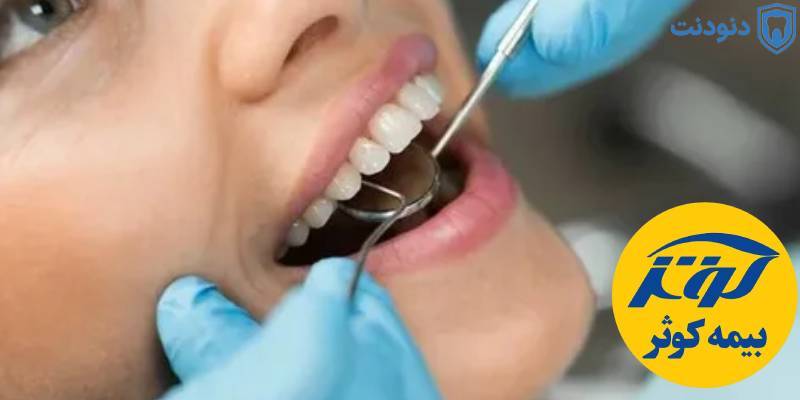 معرفی دندانپزشکی ارزان با پوشش بیمه تکمیلی معرفی دندانپزشکی ارزان با پوشش بیمه تکمیلی