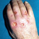 نگذاشتم انگشتانش را قطع کنند!