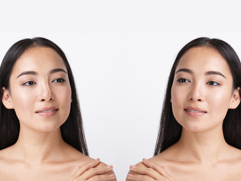 8 ویژگی کلیدی مهم در انتخاب جراح ترمیم بینی 8 ویژگی کلیدی مهم در انتخاب جراح ترمیم بینی