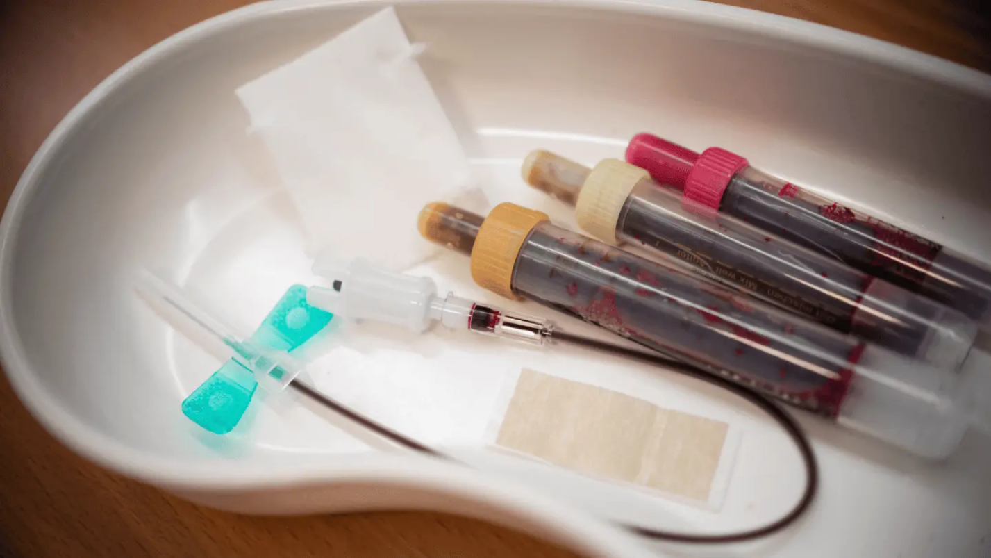 لیست آزمایش چکاپ کامل خون