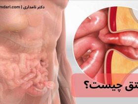 فتق چیست و چگونه به وجود می‌آید؟ | راهنمای کامل علائم، علت و درمان فتق