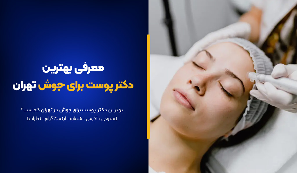 بهترین دکتر پوست برای جوش این 10تا هستند! [+آدرس و نمونه بیماران]
