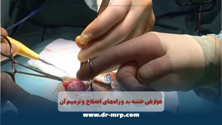 عوارض ختنه بد و راه‌های اصلاح و ترمیم آن